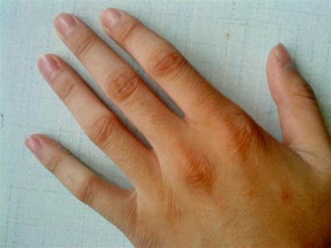 閏月生的人 手指關節紋